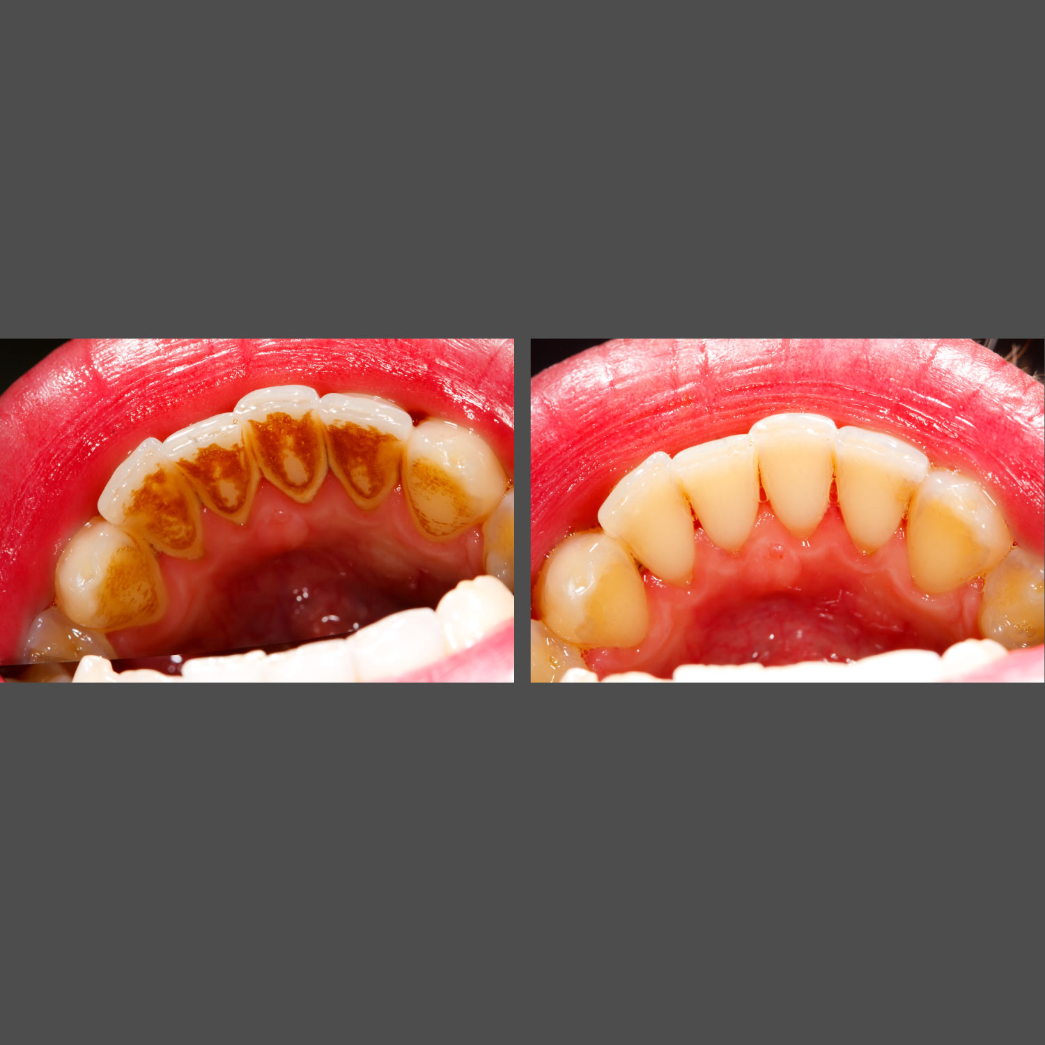 Bellevue Dentist Office