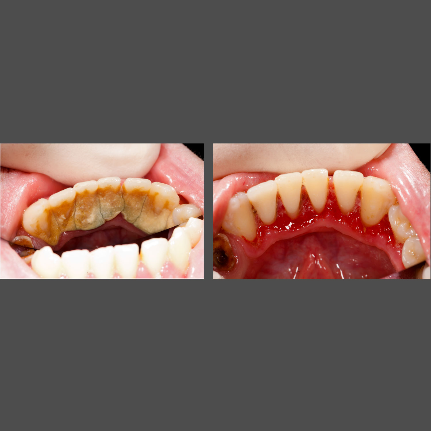 Bellevue Dentist Office